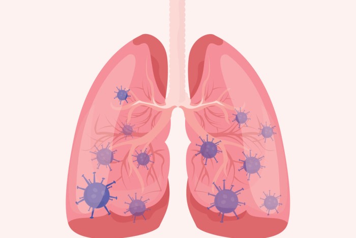 Best Pulmonologist Hospital in Vijayawada